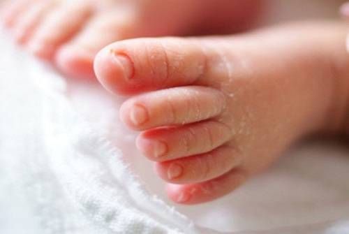 bé bị khô da ở chân