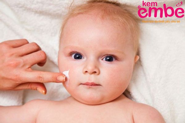 Kem bôi điều trị trị trẻ sơ sinh bị côn trùng cắn