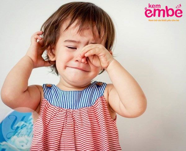 Triệu chứng khi bé bị muỗi đốt sưng mắt