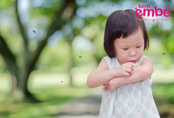 Đặc điểm cơ thể khiến trẻ bị muỗi đốt