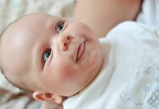 viêm da cơ địa ở trẻ sơ sinh