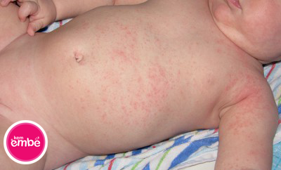 tresosinhbiromsay