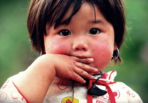 bé bị nẻ má bôi gì