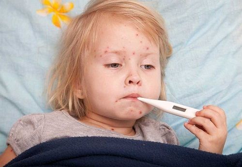 bé bị nổi mẩn đỏ