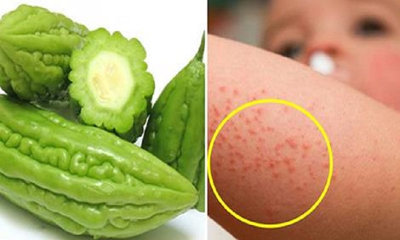 trị rôm sảy bằng mướp đắng