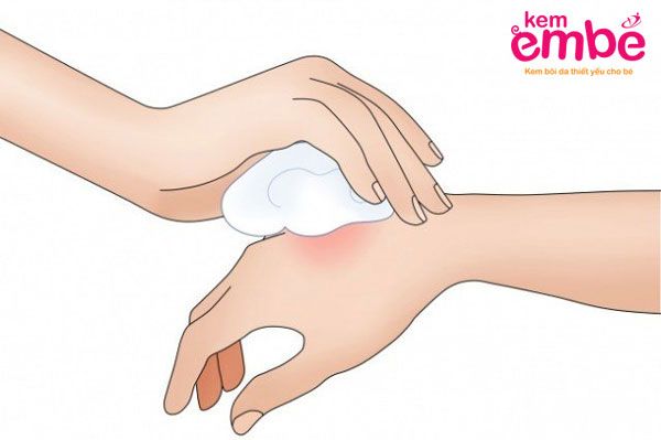 Rửa vết muỗi đốt bằng nước sạch