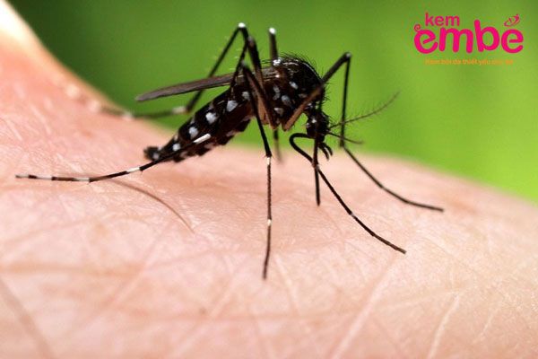 Dị ứng côn trùng cắn