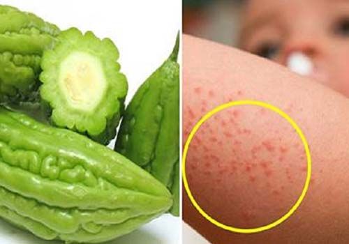 trị rôm sảy bằng mướp đắng