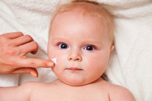 Những điều nên làm khi em bé bị nẻ má