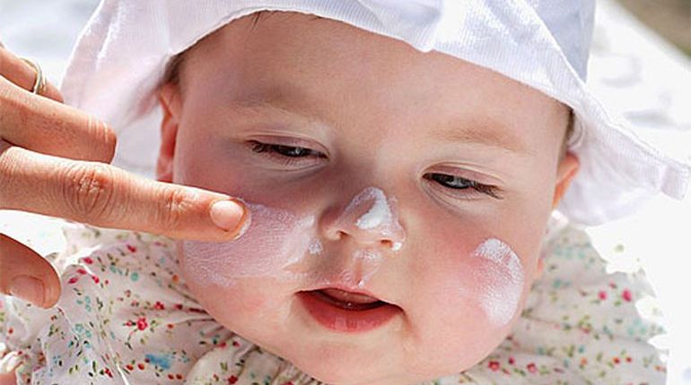 bé bị nẻ mặt bôi gì
