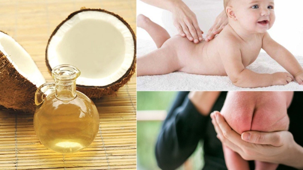 trị hăm tã bằng dầu dừa