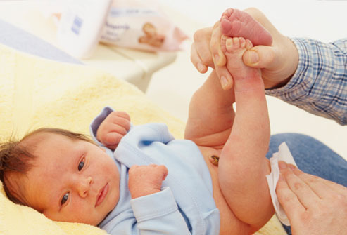 Mẹ cần thay tã thường xuyên để tránh trẻ bị hăm