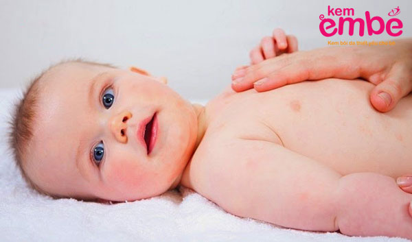 Lựa chọn kem trị sẹo em bé phù hợp với độ tuổi