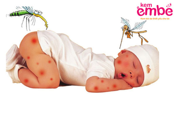 Triệu chứng khi bé bị muỗi đốt sưng môi