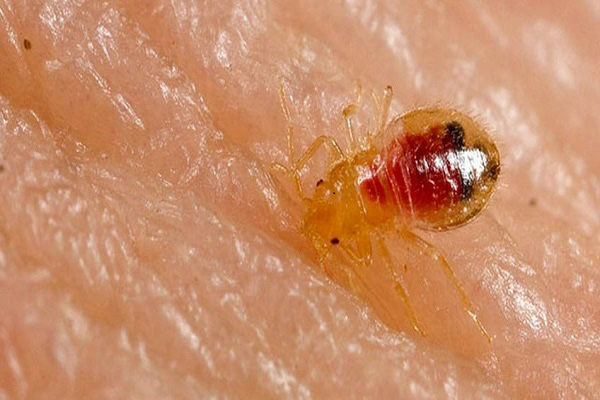 Vết cắn của rệp giường có thể gây sưng phù 