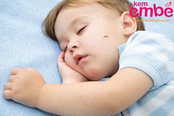 Trẻ bị muỗi cắn trong lúc ngủ