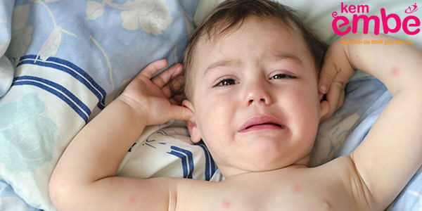 Trẻ quấy khóc khi bé bị muỗi đốt